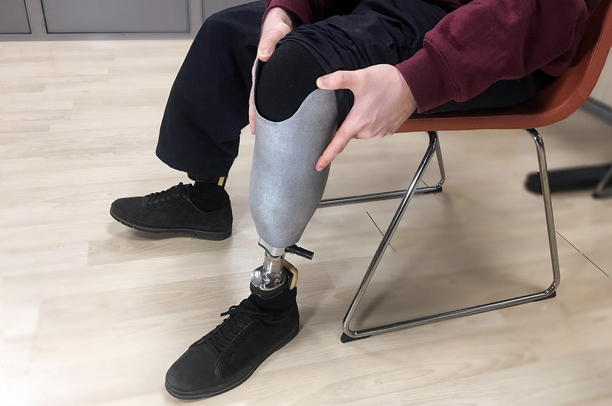 What is the Cost of a Prosthetic Leg?